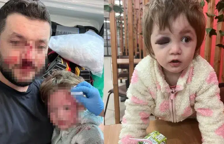 YALOVA’DA BABA İLE 14 AYLIK BEBEĞE SALDIRIDA YENİ GELİŞME!