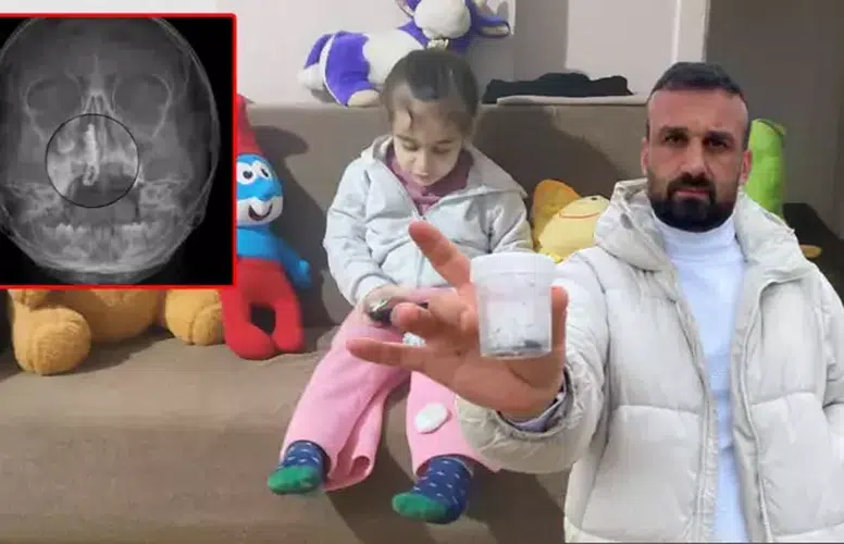 5 YAŞINDAKİ POLEN 2 YILDIR BURNUNDAKİ ZİNCİRLE YAŞAMIŞ!