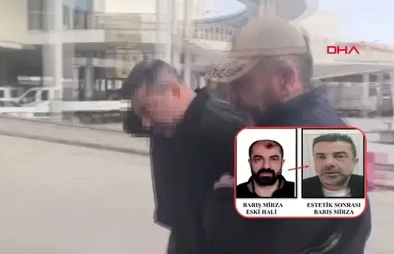 CİNAYET ZANLISI ESTETİK AMELİYATLA YÜZÜNÜ DEĞİŞTİRDİ! YİNE YAKALANDI!