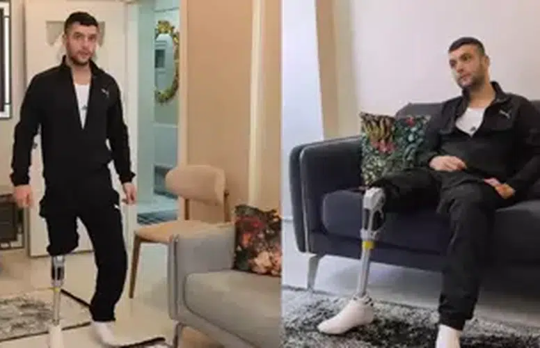 MOTOSİKLET KAZASINDA AYAĞINI KAYBEDEN GENCE HALK SAHİP ÇIKTI!