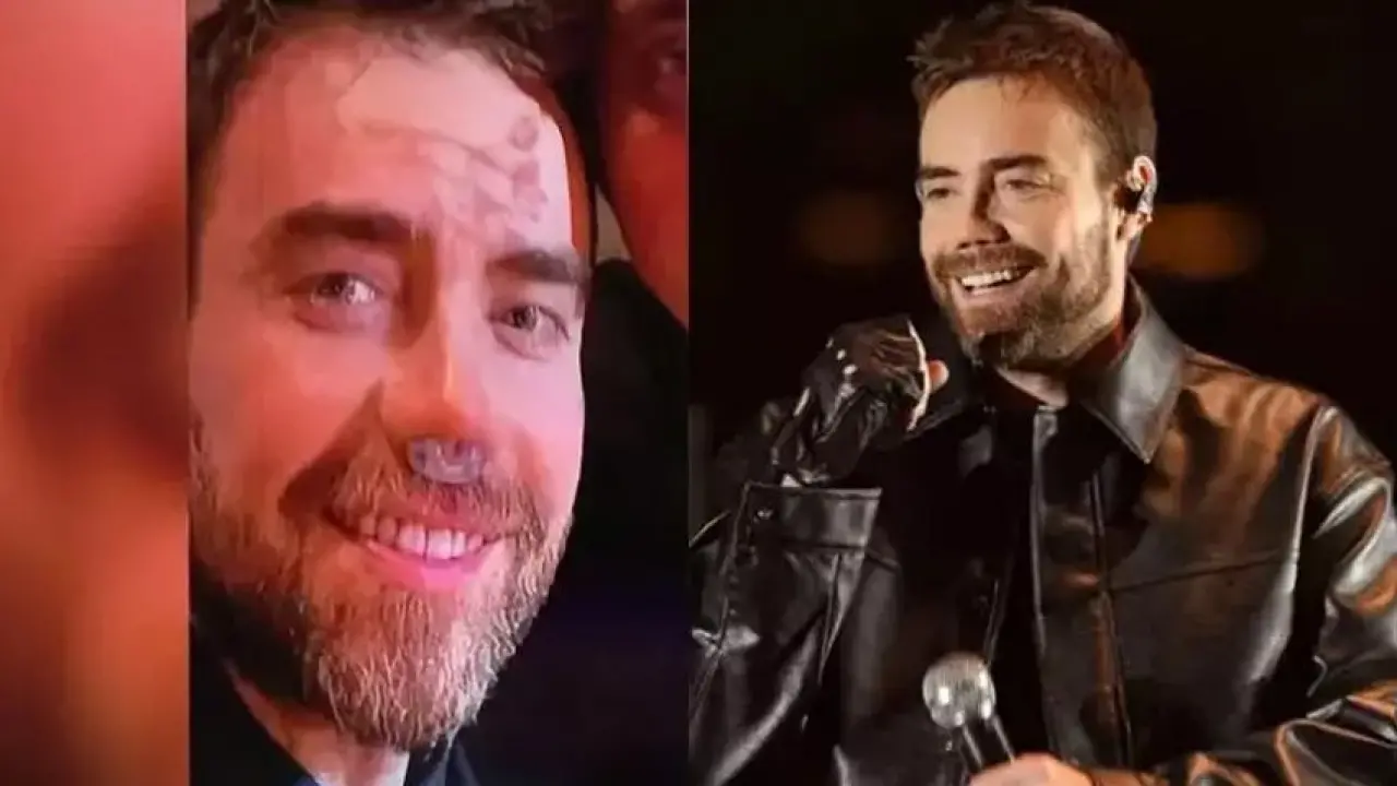 Murat Dalkılıç 12. kez burun ameliyatı oldu! Son hali ortaya çıktı - Sayfa 5